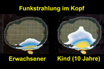 Eindringtiefe von Funkstrahlung in den Kopf von Menschen 